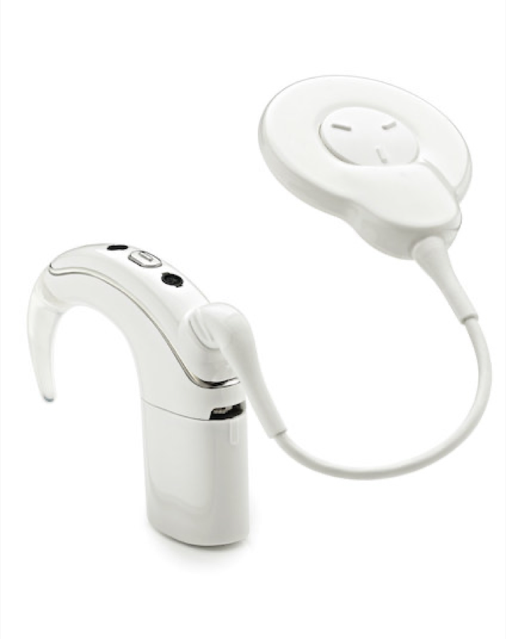 Cochlear implant processor